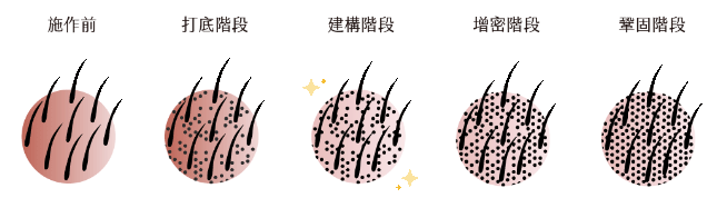 復密 施作過程示意