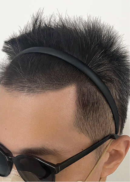 紋髪濃密案例_3