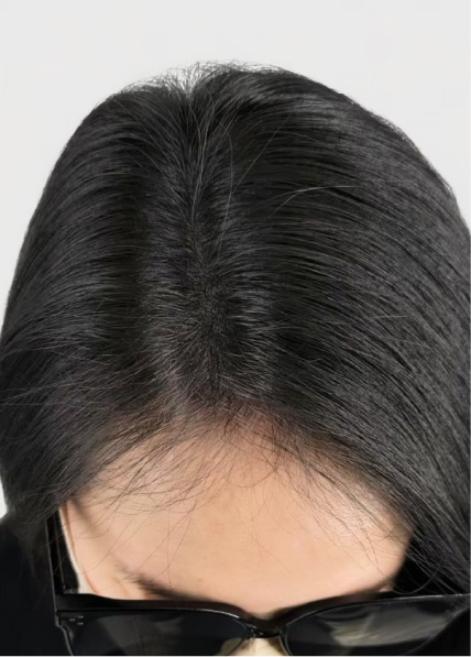 紋髪濃密案例_3