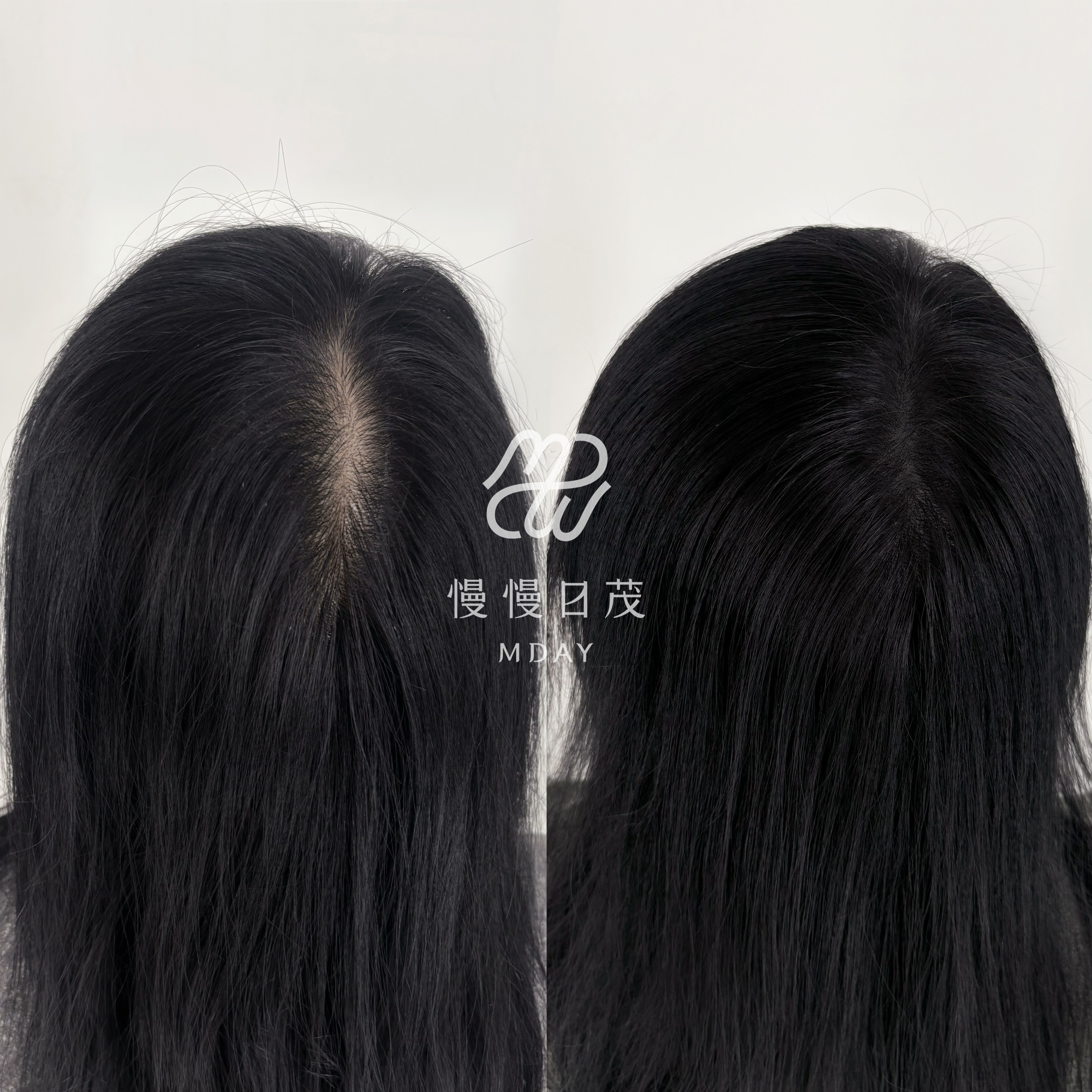 女性後腦勺填補