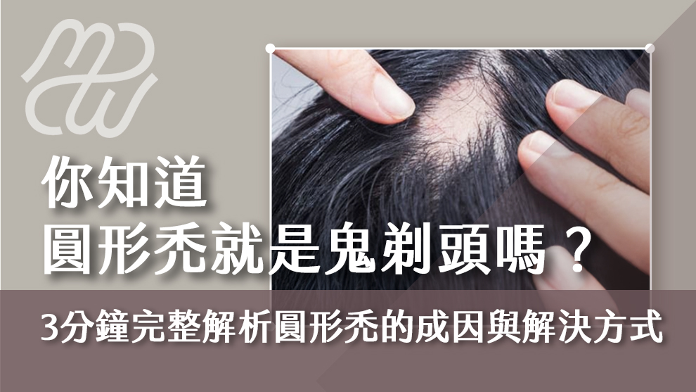 圓形禿是什麼？你知道圓形禿就是鬼剃頭嗎？三分鐘完整解析圓形禿的成因與解決方式