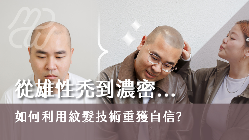 從雄性禿到濃密秀髮：如何利用紋髮技術重獲自信？