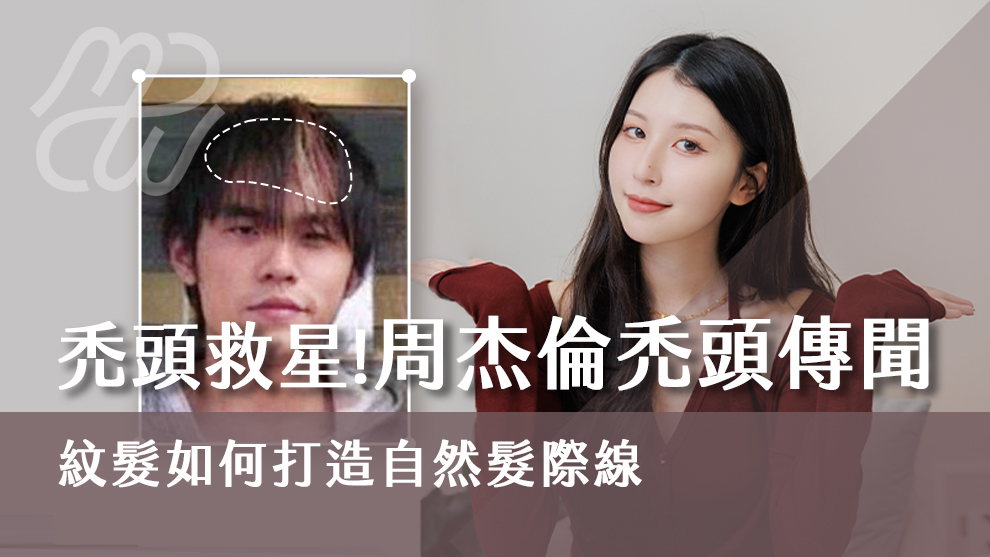 禿頭救星！解析周杰倫禿頭傳聞，紋髮如何打造自然髮際線？