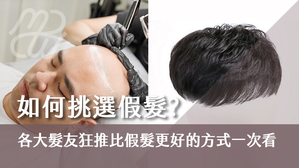 如何挑選假髮？各大髮友狂推比假髮更好的方式一次看！