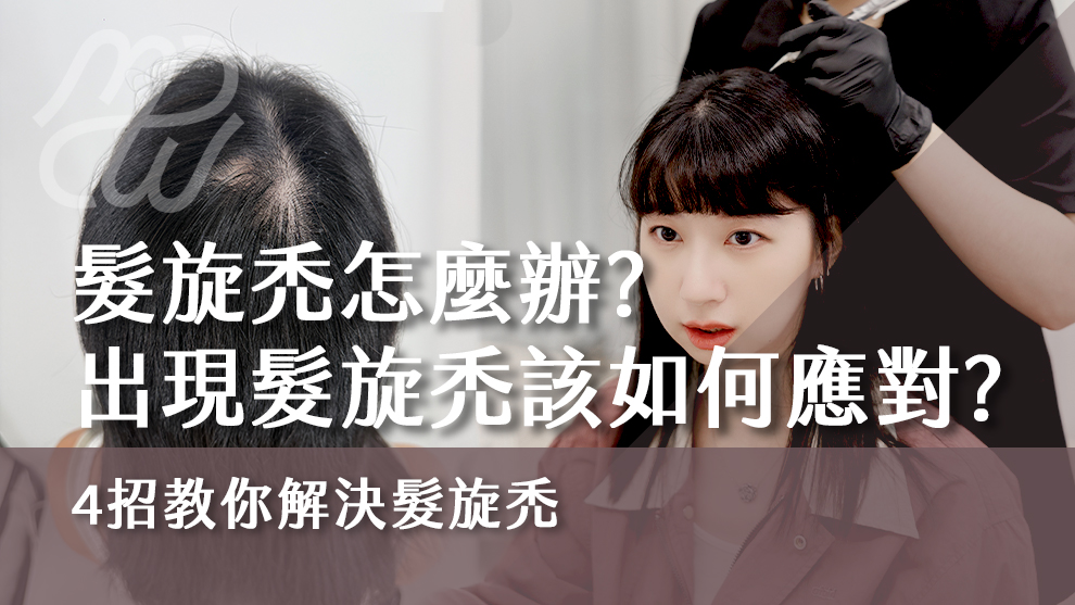 髮旋禿怎麼辦？如果出現髮旋禿該如何應對？四招教你解決髮旋禿！