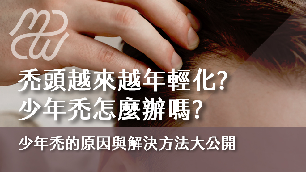 禿頭越來越年輕化？少年禿怎麼辦嗎？少年禿的原因與解決方法大公開