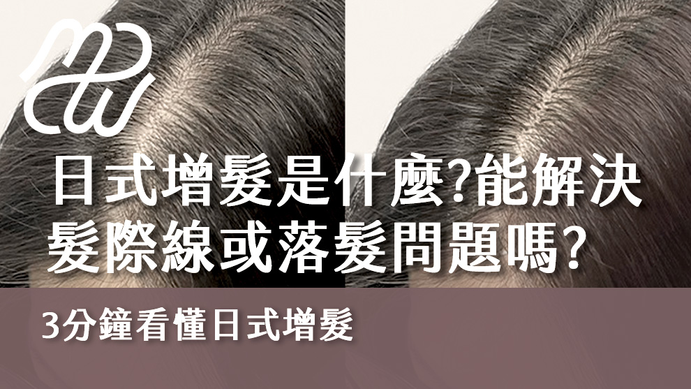 日式增髮是什麼？日式增髮能夠解決髮際線或落髮問題？三分鐘看懂日式增髮！