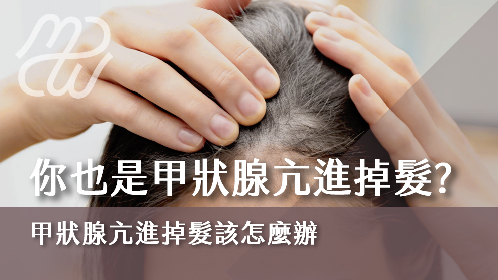 你也是甲狀腺亢進掉髮嗎？甲狀腺亢進掉髮該怎麼辦？