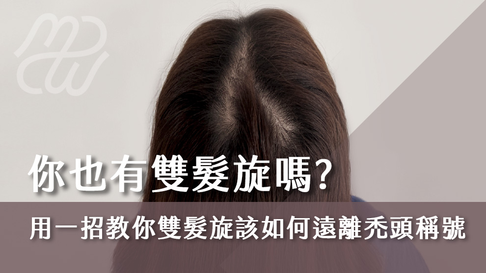 你也有雙髮旋嗎？用一招教你雙髮旋該如何遠離禿頭稱號！