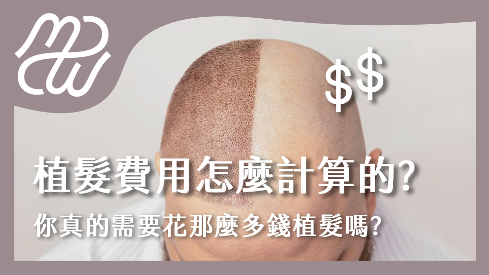 植髮費用怎麼計算的？你真的需要花那麼多錢植髮嗎？