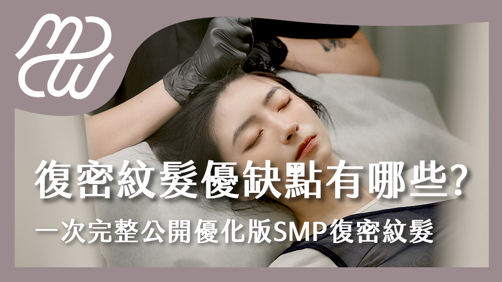 復密紋髮優缺點有哪些？一次完整公開優化版SMP復密紋髮