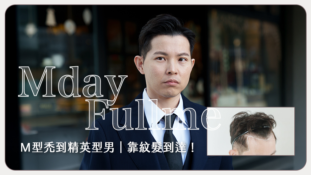 【素人改造】35歲男性M型禿：慢慢日茂復密紋髮改造記錄