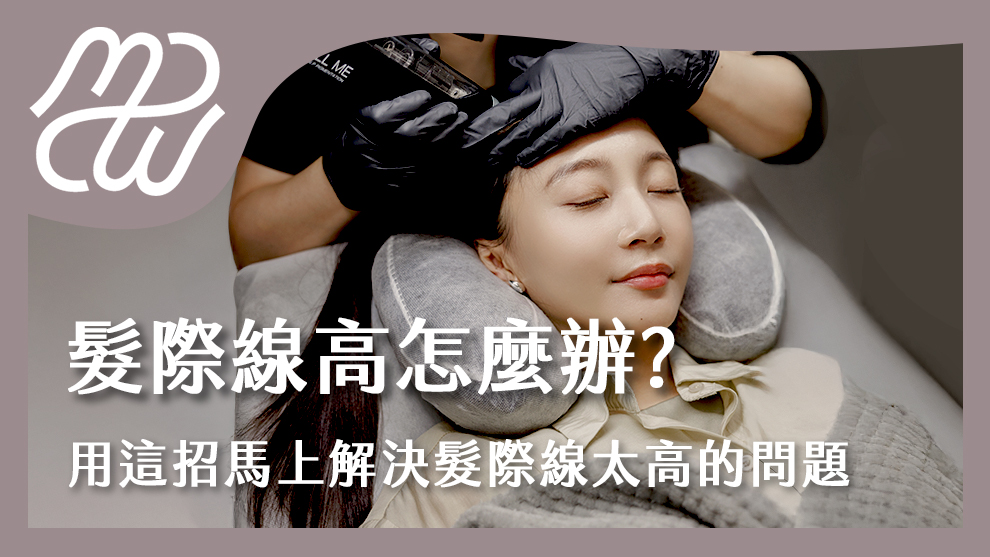 髮際線高怎麼辦？用這招馬上解決髮際線太高的問題