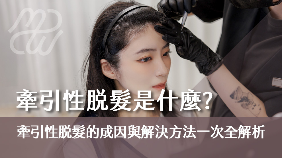 牽引性脫髮是什麼？牽引性脫髮的成因與解決方法一次全解析！