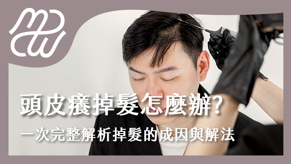 頭皮癢掉髮怎麼辦？一次完整解析頭皮很癢掉髮的成因與解決方法