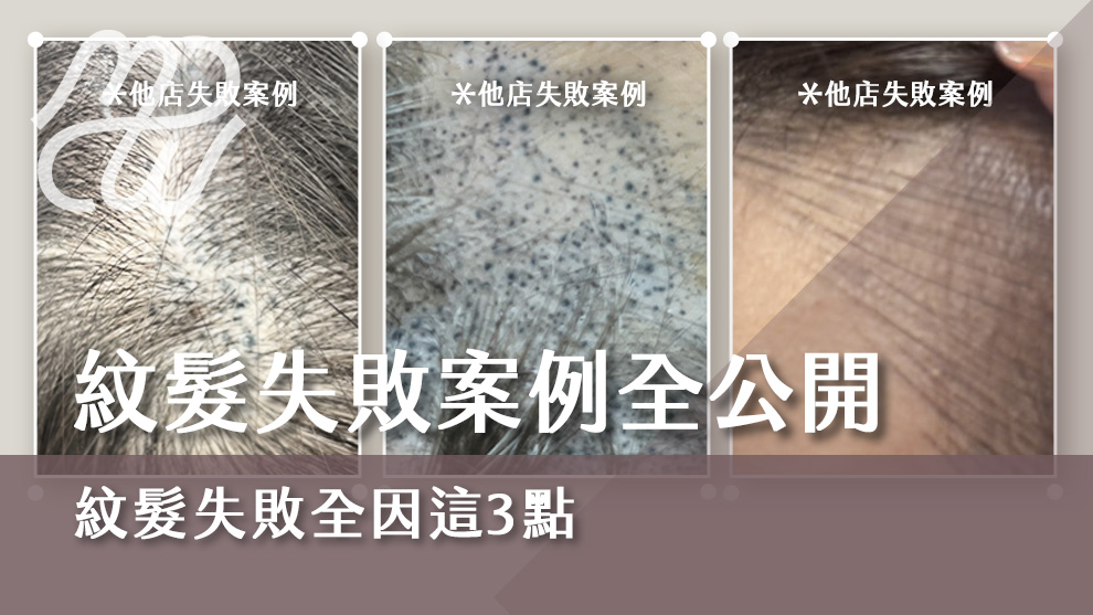 紋髮失敗案例全公開，紋髮失敗全因這三點！