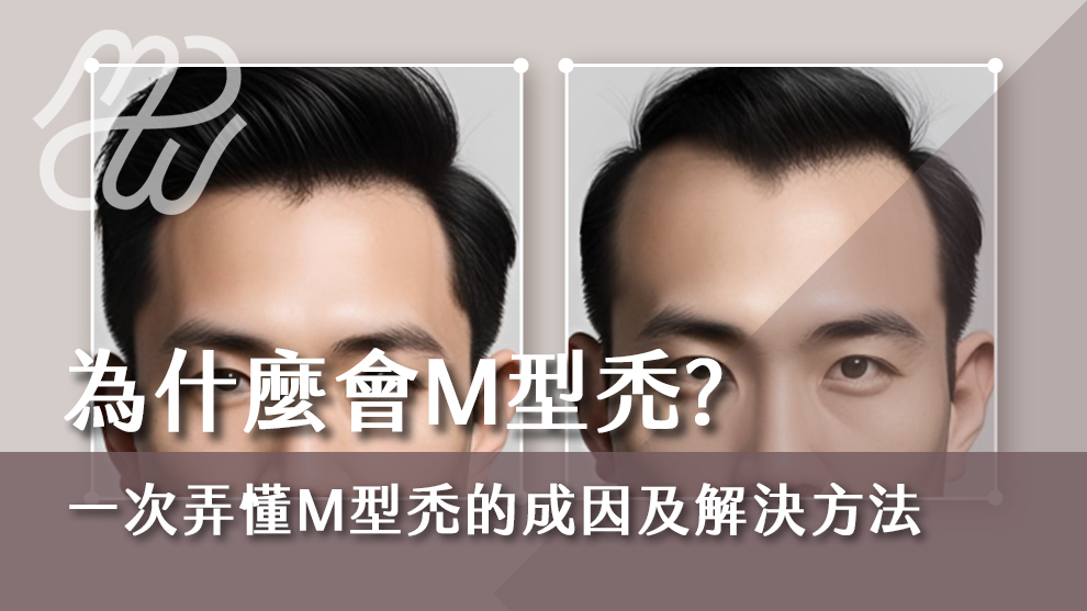 為什麼會M型禿？一次弄懂M型禿的成因及解決方法