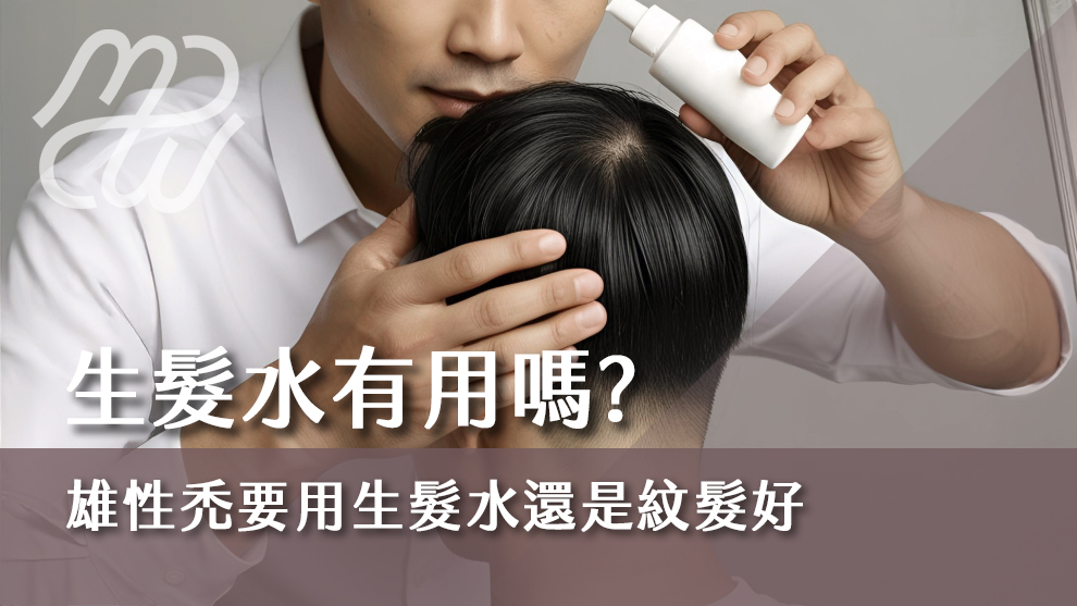 生髮水有用嗎？雄性禿要用生髮水還是紋髮好？