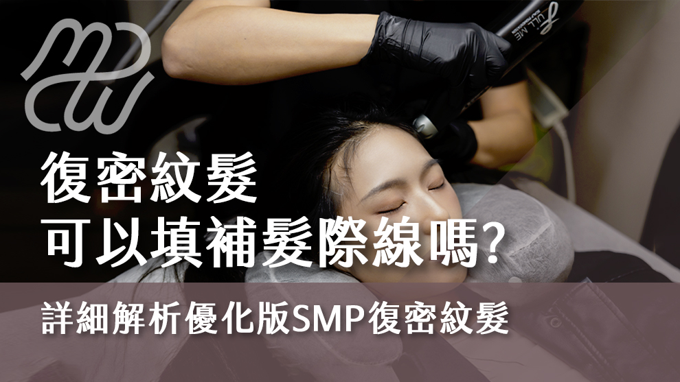 復密紋髮可以填補髮際線嗎？詳細解析優化版SMP復密紋髮