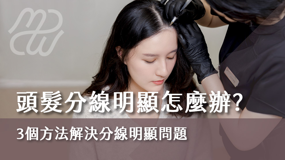 頭髮分線明顯怎麼辦？三個方法解決分線明顯問題
