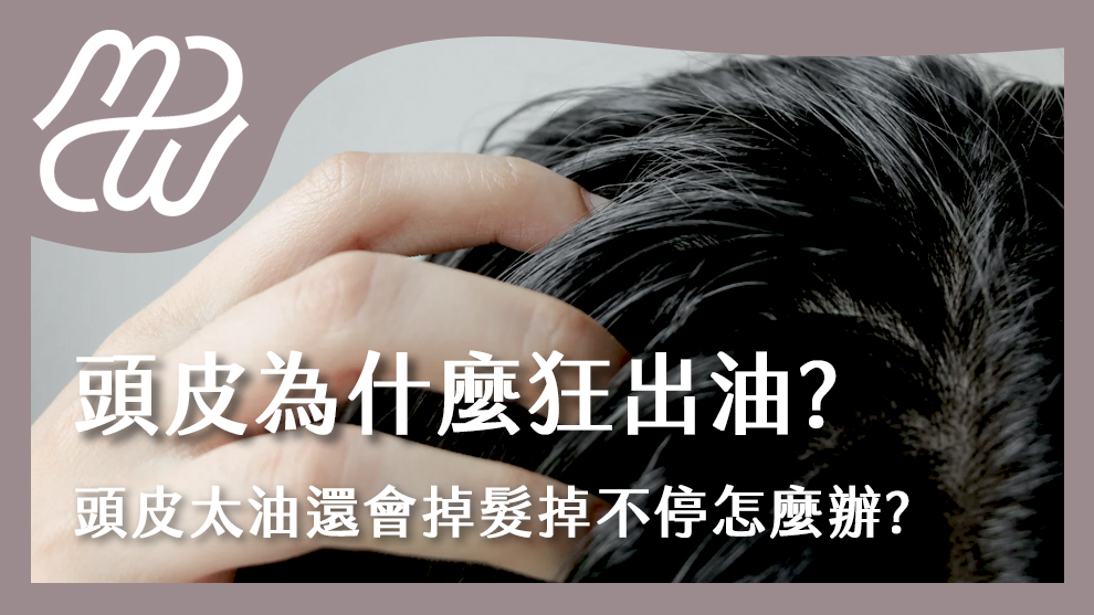 頭皮為什麼狂出油？頭皮太油還會掉髮掉不停怎麼辦？