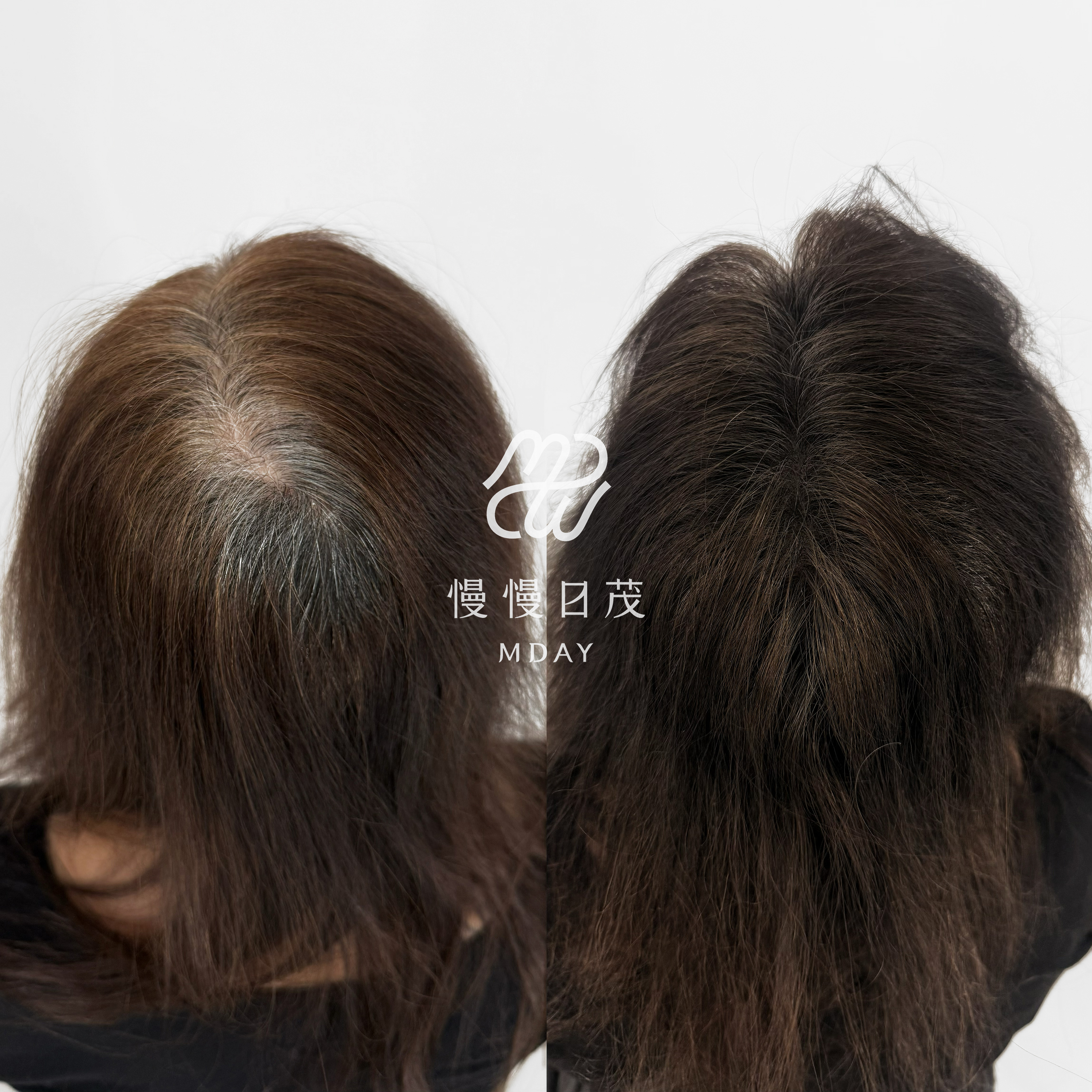 女性後腦勺填補