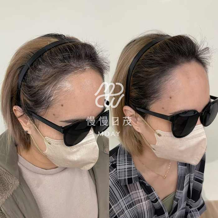 染髮＆白髮