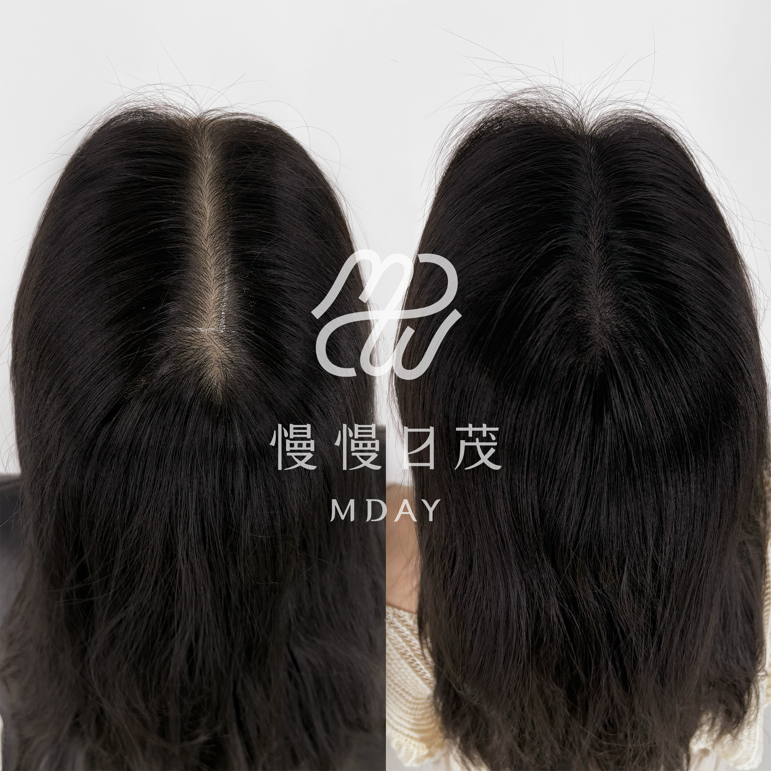 女性後腦勺填補